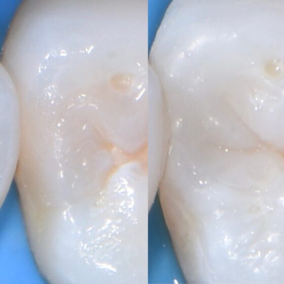 宇部市第一歯科