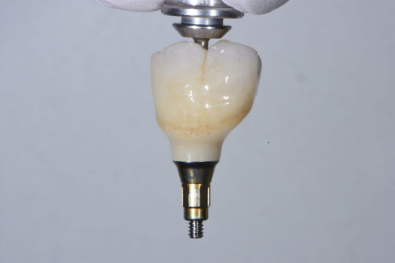 宇部市第一歯科